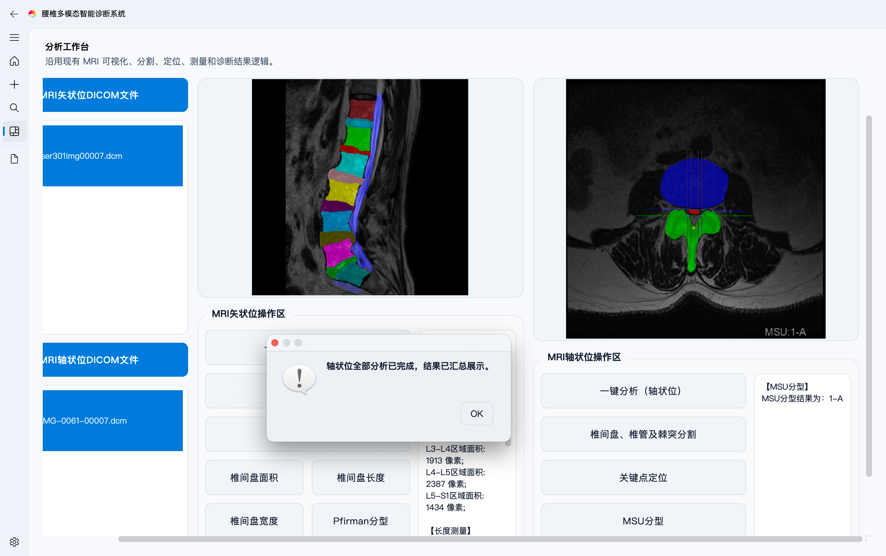 轴状位分析（点击放大）