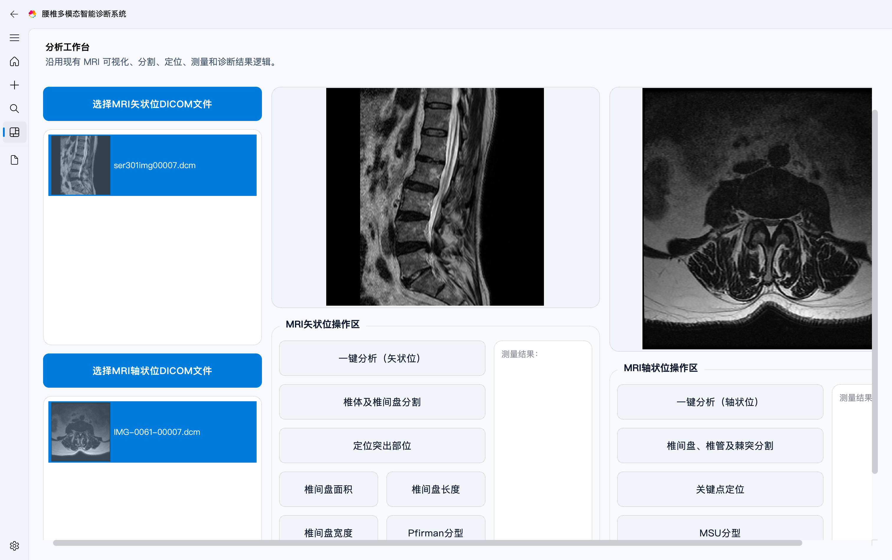 影像导入与分析